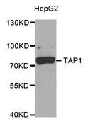 ABCB2 / TAP1 Antibody - Western blot analysis of extracts of HepG2 cells.