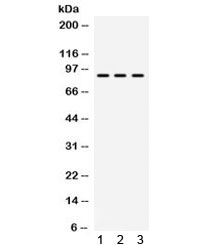 ABCB2 / TAP1 Antibody