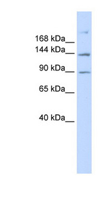 ABCB4 / MDR3 Antibody - ABCB4 antibody Western blot of 293T cell lysate. This image was taken for the unconjugated form of this product. Other forms have not been tested.