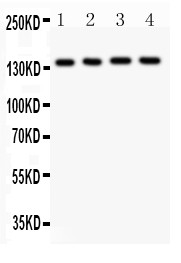 ABCB4 / MDR3 Antibody - ABCB4 antibody Western blot. All lanes: Anti ABCB4 at 0.5 ug/ml. Lane 1: MCF-7 Whole Cell Lysate at 40 ug. Lane 2: SW620 Whole Cell Lysate at 40 ug. Lane 3: 22RV1 Whole Cell Lysate at 40 ug. Lane 4: SKOV Whole Cell Lysate at 40 ug. Predicted band size: 142 kD. Observed band size: 142 kD.