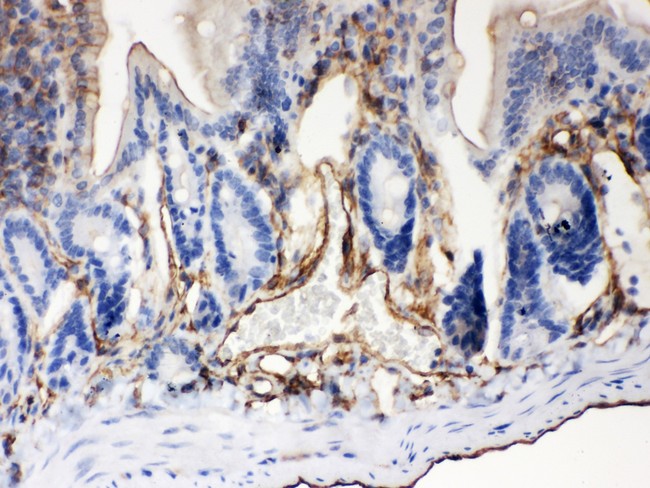 ABCB4 / MDR3 Antibody - ABCB4 antibody IHC-paraffin: Mouse Intestine Tissue.