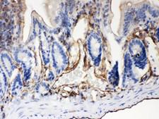 ABCB4 / MDR3 Antibody - ABCB4 antibody IHC-paraffin: Mouse Intestine Tissue.