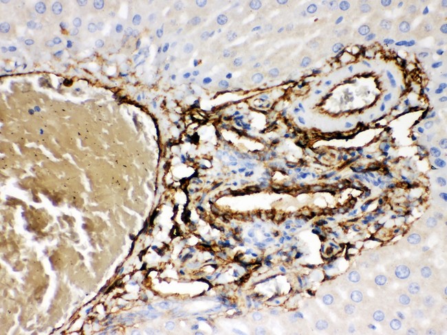 ABCB4 / MDR3 Antibody - ABCB4 antibody IHC-paraffin: Rat Liver Tissue.