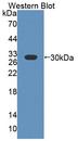 ABCB4 / MDR3 Antibody - Western Blot; Sample: Recombinant protein.