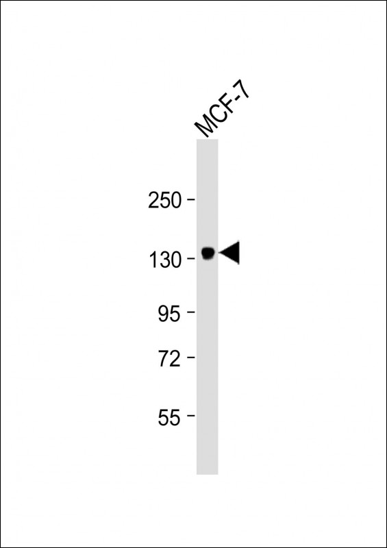 ABCB4 / MDR3 Antibody - Anti-ABCB4 Antibody at 1:4000 dilution + MCF-7 whole cell lysate Lysates/proteins at 20 µg per lane. Secondary Goat Anti-mouse IgG, (H+L), Peroxidase conjugated at 1/10000 dilution. Predicted band size: 142 kDa Blocking/Dilution buffer: 5% NFDM/TBST.