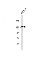 ABCB4 / MDR3 Antibody - Anti-ABCB4 Antibody at 1:4000 dilution + MCF-7 whole cell lysate Lysates/proteins at 20 µg per lane. Secondary Goat Anti-mouse IgG, (H+L), Peroxidase conjugated at 1/10000 dilution. Predicted band size: 142 kDa Blocking/Dilution buffer: 5% NFDM/TBST.
