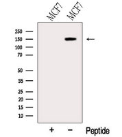 ABCB4 / MDR3 Antibody - Western blot analysis of extracts of 3T3 cells using MDR3 antibody. The lane on the left was treated with blocking peptide.