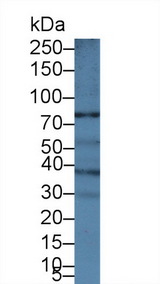 ABCB5 Antibody - Western Blot; Sample: Human A431 cell lysate; Primary Ab: 1µg/ml Rabbit Anti-Human ABCB5 Antibody Second Ab: 0.2µg/mL HRP-Linked Caprine Anti-Rabbit IgG Polyclonal Antibody