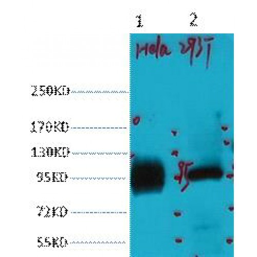 ABCB5 Antibody - Western blot of ABCB5 antibody