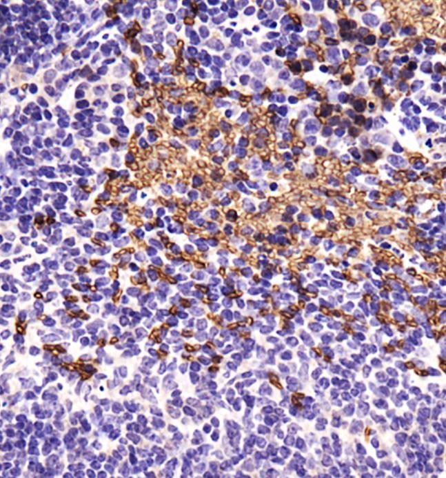 ABCB5 Antibody - Immunohistochemistry: ABCB5 Antibody - Analysis of ABCB5 in mouse spleen using DAB with hematoxylin counterstain.  This image was taken for the unconjugated form of this product. Other forms have not been tested.