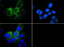 ABCB5 Antibody - Immunocytochemistry/Immunofluorescence: ABCB5 Antibody - ABCB5 antibody was tested in A431 cells with FITC (green). Nuclei were counterstained with DAPI (blue).  This image was taken for the unconjugated form of this product. Other forms have not been tested.