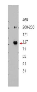 ABCB5 Antibody - Western blot using the affinity purified anti-ABCB5 antibody shows detection of ABCB5 beta in ~12.5 ug of transfected-Hi5 whole cell lysate. No reaction was seen when antibody was pre-incubated with the immunizing peptide (data not shown). A 3-8% Tris-acetate gel was used for separation. The arrowhead corresponds to 117 kDa ABCB5. The membrane was probed with the primary antibody at a 1:10,000 dilution in 5% milk in TBST at 4° C, overnight.