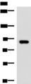 ABCB5 Antibody - Western blot analysis of 293T cell lysate  using ABCB5 Polyclonal Antibody at dilution of 1:500