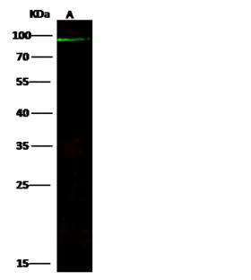 ABCB5 Antibody - Anti-ABCB5 rabbit polyclonal antibody at 1:500 dilution. Lane A: K562 Membrane Lysate. Lysates/proteins at 30 ug per lane. Secondary: Goat Anti-Rabbit IgG H&L (Dylight800) at 1/10000 dilution. Developed using the Odyssey technique. Performed under reducing conditions. Predicted band size: 90 kDa. Observed band size: 90 kDa.