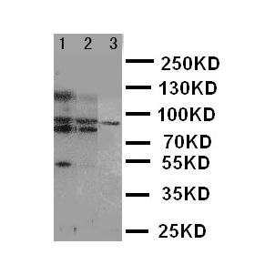 ABCB6 Antibody - WB of ABCB6 antibody. Lane 1: HELA Cell Lysate. Lane 2: MCF-7 Cell Lysate. Lane 3: A549 Cell Lysate.