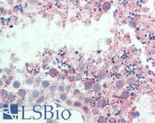 ABCB6 Antibody - Human Testis: Formalin-Fixed, Paraffin-Embedded (FFPE)