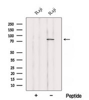 ABCB6 Antibody - Western blot analysis of extracts of Raji cells using ABCB6 antibody. The lane on the left was treated with blocking peptide.