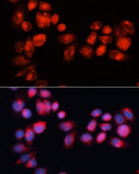 ABCB7 Antibody - Immunofluorescence analysis of HeLa cells using ABCB7 antibody at dilution of 1:100 (40x lens). Blue: DAPI for nuclear staining.