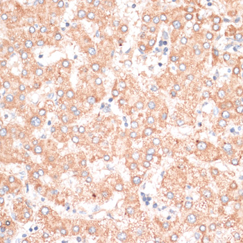 ABCB7 Antibody - Immunohistochemistry of paraffin-embedded human liver using ABCB7 antibody at dilution of 1:100 (40x lens).