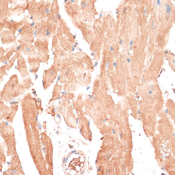 ABCB7 Antibody - Immunohistochemistry of paraffin-embedded mouse heart using ABCB7 antibody at dilution of 1:100 (40x lens).