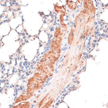 ABCB7 Antibody - Immunohistochemistry of paraffin-embedded mouse lung using ABCB7 antibody at dilution of 1:100 (40x lens).