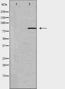 ABCB7 Antibody - Western blot analysis of extracts of HepG2 cells using ABCB7 antibody. The lane on the left is treated with the antigen-specific peptide.
