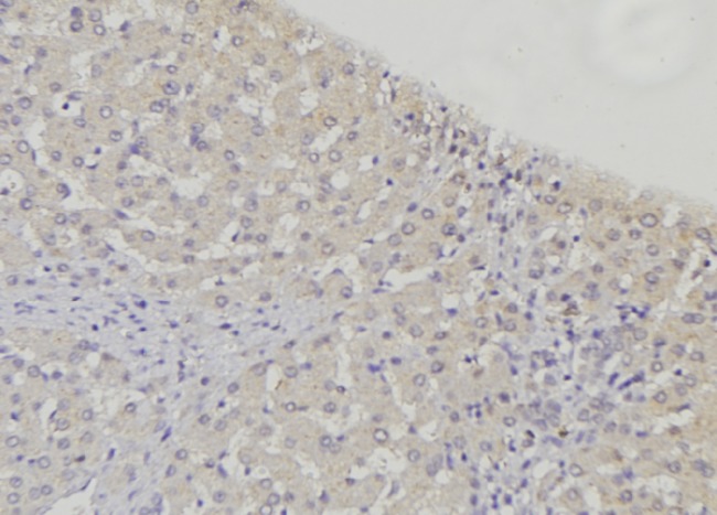 ABCB7 Antibody - 1:100 staining mouse liver tissue by IHC-P. The sample was formaldehyde fixed and a heat mediated antigen retrieval step in citrate buffer was performed. The sample was then blocked and incubated with the antibody for 1.5 hours at 22°C. An HRP conjugated goat anti-rabbit antibody was used as the secondary.