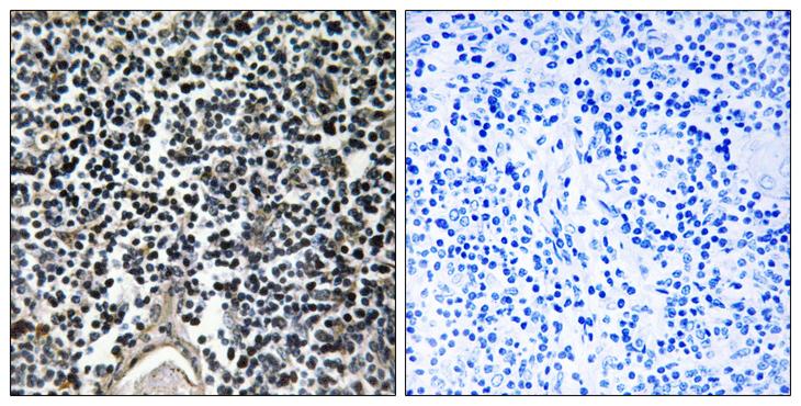 ABCB7 Antibody - Peptide - + Immunohistochemistry analysis of paraffin-embedded human thymus gland tissue using ABCB7 antibody.