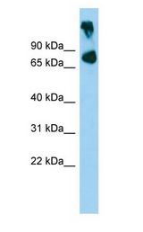ABCB8 Antibody - ABCB8 antibody Western Blot of Mouse Muscle.  This image was taken for the unconjugated form of this product. Other forms have not been tested.