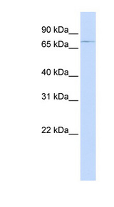 ABCB8 Antibody - ABCB8 antibody Western blot of Fetal Heart lysate. This image was taken for the unconjugated form of this product. Other forms have not been tested.
