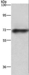 ABCB8 Antibody - Western blot analysis of Mouse heart tissue, using ABCB8 Polyclonal Antibody at dilution of 1:750.