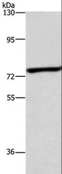ABCB8 Antibody - Western blot analysis of Mouse heart tissue, using ABCB8 Polyclonal Antibody at dilution of 1:600.