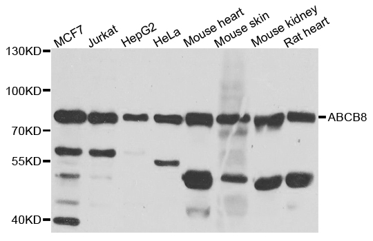 ABCB8 Antibody - Western blot analysis of extract of various cells.