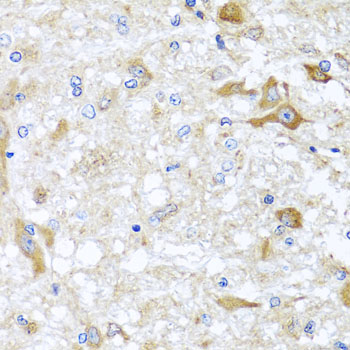 ABCB8 Antibody - Immunohistochemistry of paraffin-embedded rat brain tissue.
