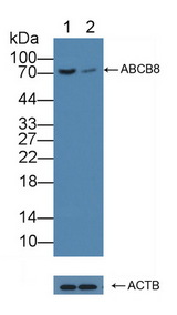 ABCB8 Antibody - Knockout Varification: Lane 1: Wild-type Hela cell lysate; Lane 2: ABCB8 knockout Hela cell lysate; Predicted MW: 59,68,80kd Observed MW: 75kd Primary Ab: 1µg/ml Rabbit Anti-Human ABCB8 Antibody Second Ab: 0.2µg/mL HRP-Linked Caprine Anti-Rabbit IgG Polyclonal Antibody
