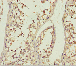 ABCB8 Antibody - Immunohistochemistry of paraffin-embedded human testis tissue at dilution 1:100