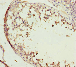 ABCB8 Antibody - Immunohistochemistry of paraffin-embedded human testis tissue at dilution 1:100