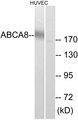 ABCB8 Antibody - Western blot analysis of extracts from HUVEC cells, using ABCA8 antibody.