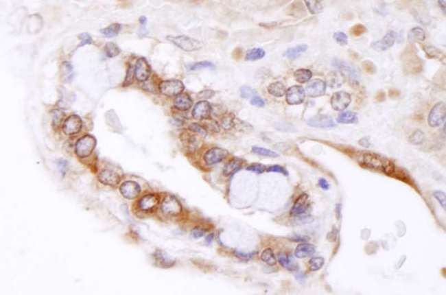 ABCB9 Antibody - Detection of Mouse ABCB9 by Immunohistochemistry. Sample: FFPE section of mouse teratoma. Antibody: Affinity purified rabbit anti-ABCB9 used at a dilution of 1:100.