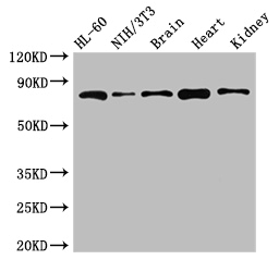 ABCB9 Antibody - Positive WB detected in:HL-60 whole cell lysate,NIH/3T3 whole cell lysate,Mouse brain tissue,Mouse heart tissue,Mouse kidney tissue;All lanes:ABCB9 antibody at 5ug/ml;Secondary;Goat polyclonal to rabbit IgG at 1/50000 dilution;Predicted band size: 85,80,67,76,78 kDa;Observed band size: 85 kDa;
