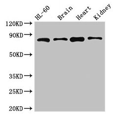 ABCB9 Antibody - Western Blot Positive WB detected in: HL60 whole cell lysate, Mouse brain tissue, Mouse heart tissue, Mouse kidney tissue All lanes: ABCB9 antibody at 5µg/ml Secondary Goat polyclonal to rabbit IgG at 1/50000 dilution Predicted band size: 85, 80, 67, 76, 78 kDa Observed band size: 85 kDa