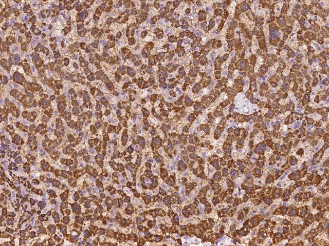 ABCB9 Antibody - Immunochemical staining of human ABCB9 in human liver with rabbit polyclonal antibody at 1:100 dilution, formalin-fixed paraffin embedded sections.