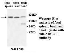 ABCC10 Antibody