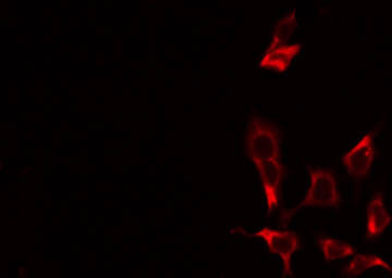 ABCC10 Antibody - Staining COLO205 cells by IF/ICC. The samples were fixed with PFA and permeabilized in 0.1% Triton X-100, then blocked in 10% serum for 45 min at 25°C. The primary antibody was diluted at 1:200 and incubated with the sample for 1 hour at 37°C. An Alexa Fluor 594 conjugated goat anti-rabbit IgG (H+L) Ab, diluted at 1/600, was used as the secondary antibody.
