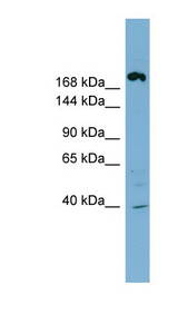 ABCC11 / MRP8 Antibody - ABCC11 antibody Western blot of NCI-H226 cell lysate. This image was taken for the unconjugated form of this product. Other forms have not been tested.