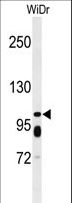 ABCC11 / MRP8 Antibody - Western blot of ABCC11 Antibody in WiDr cell line lysates (35 ug/lane). ABCC11 (arrow) was detected using the purified antibody.