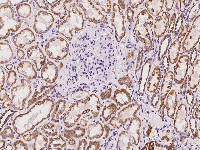 ABCC11 / MRP8 Antibody - Immunochemical staining of human ABCC11 in human kidney with rabbit polyclonal antibody at 1:100 dilution, formalin-fixed paraffin embedded sections.