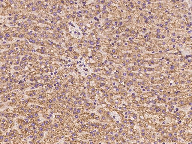 ABCC11 / MRP8 Antibody - Immunochemical staining of human ABCC11 in human liver with rabbit polyclonal antibody at 1:100 dilution, formalin-fixed paraffin embedded sections.