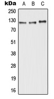 ABCC11 / MRP8 Antibody - Western blot analysis of ABCC11 expression in HepG2 (A); Raw264.7 (B); H9C2 (C) whole cell lysates.