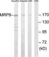 ABCC12 / MRP9 Antibody - Western blot analysis of lysates from 293, HepG2, and HUVEC cells, using MRP9 Antibody. The lane on the right is blocked with the synthesized peptide.